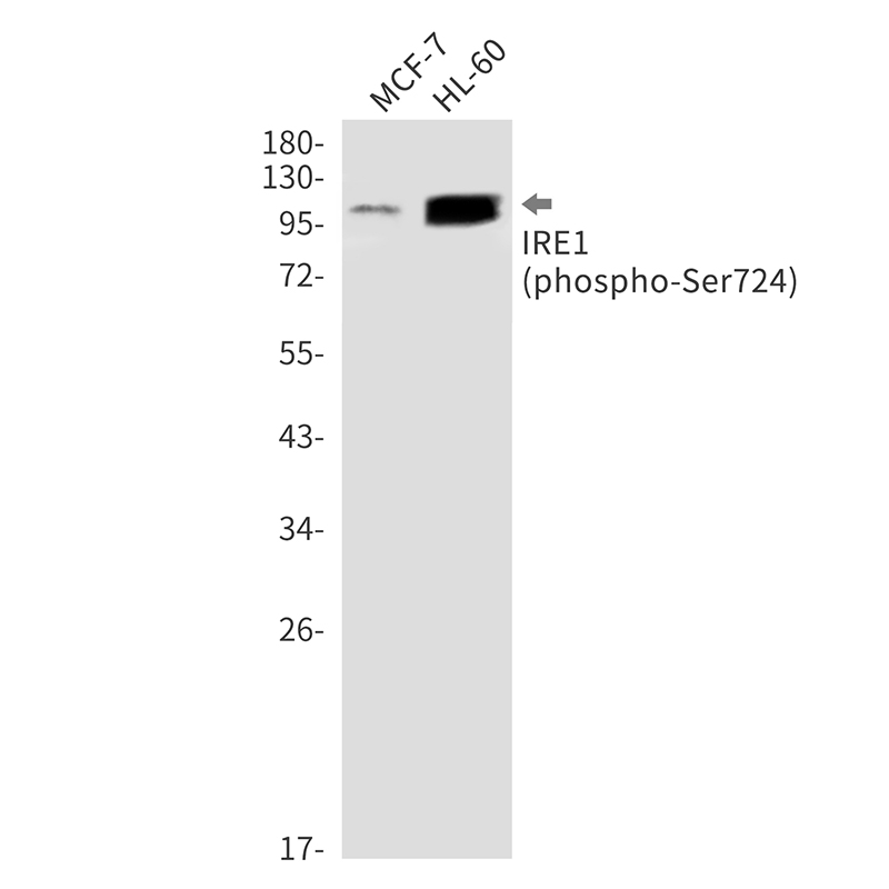 Rabbit monoclonal antibody