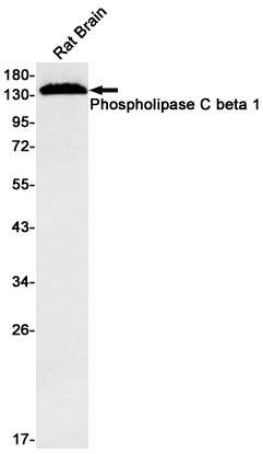 Rabbit monoclonal antibody