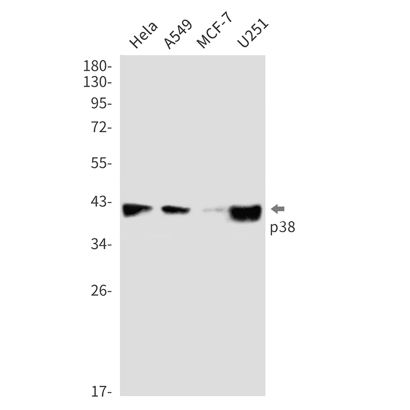 Rabbit monoclonal antibody