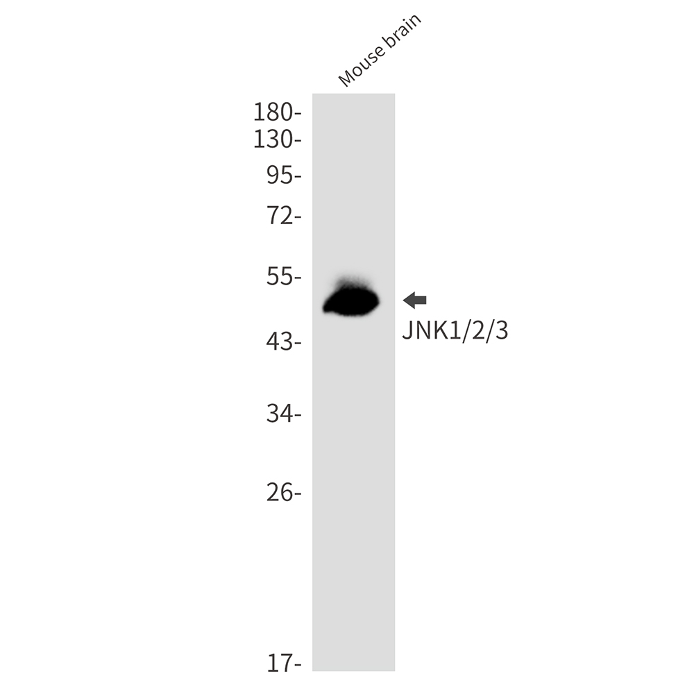 Rabbit monoclonal antibody