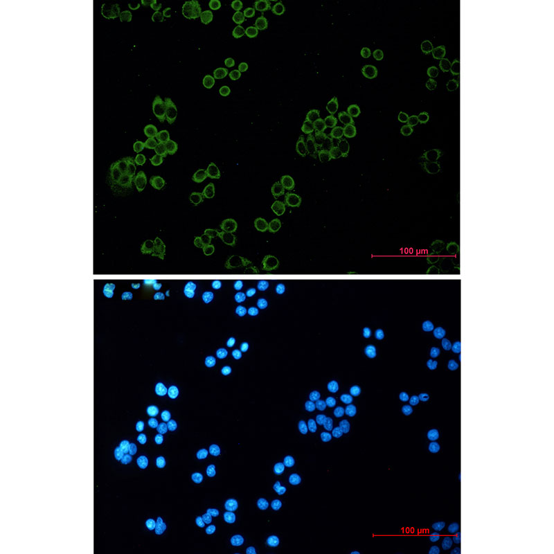 Rabbit monoclonal antibody