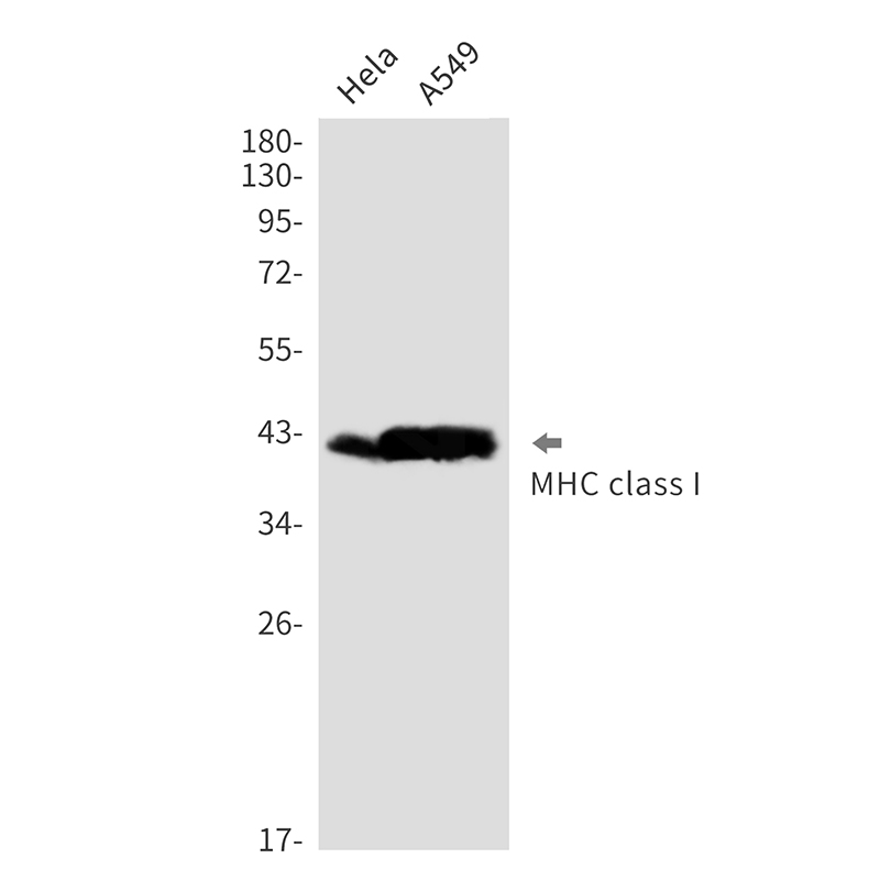Rabbit monoclonal antibody