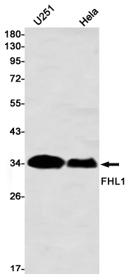 Rabbit monoclonal antibody