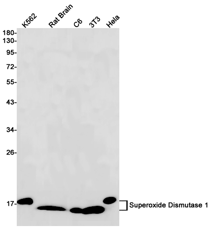 Rabbit monoclonal antibody