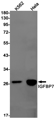 Rabbit monoclonal antibody