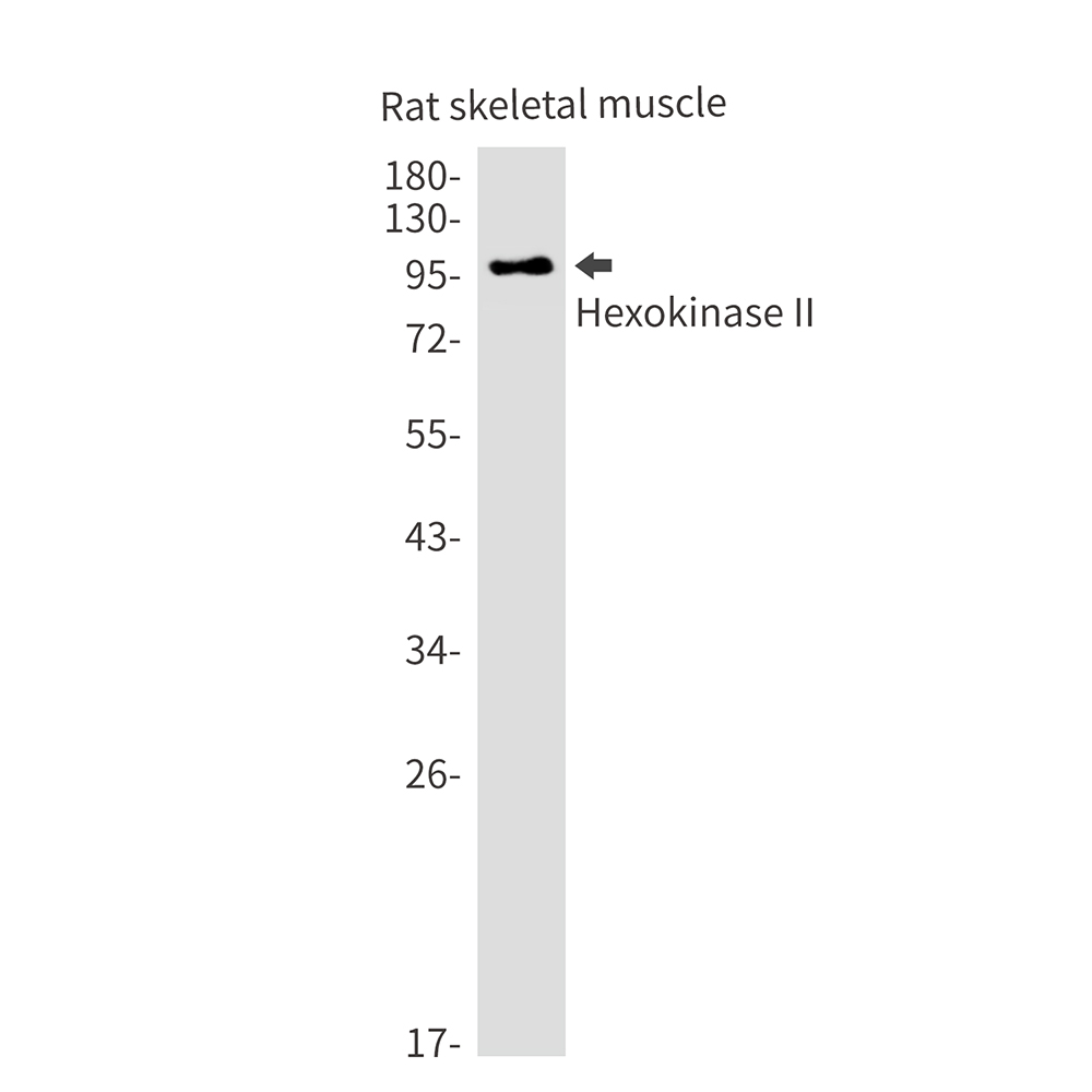 Rabbit monoclonal antibody
