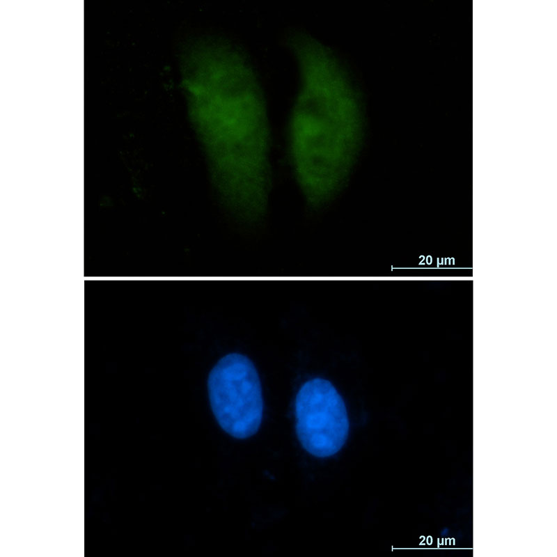 Rabbit monoclonal antibody