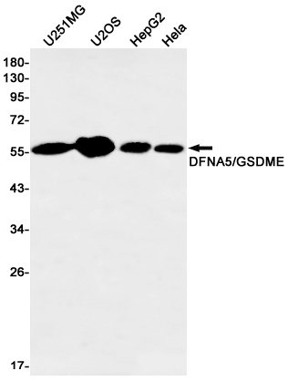 Rabbit monoclonal antibody