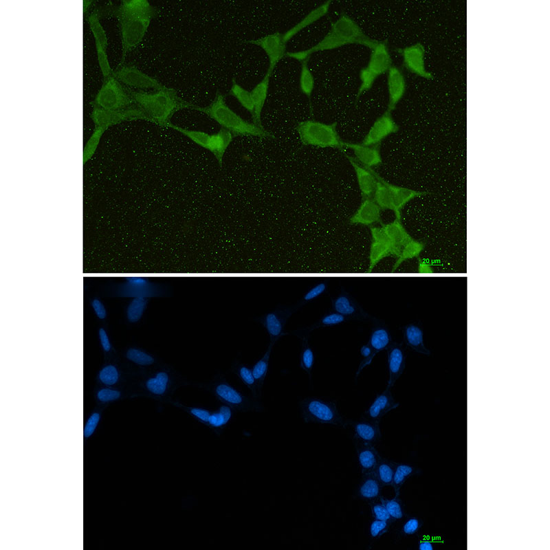 Rabbit monoclonal antibody