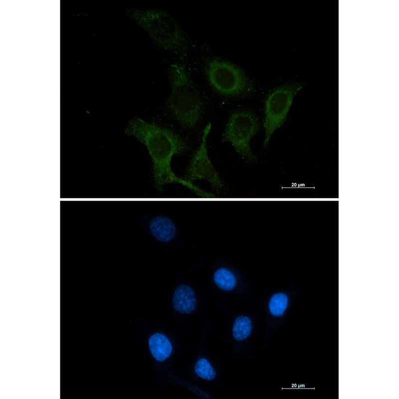 Rabbit monoclonal antibody