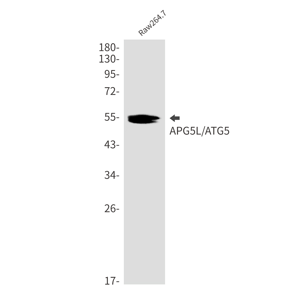 Rabbit monoclonal antibody