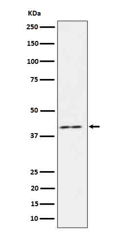 Rabbit monoclonal antibody