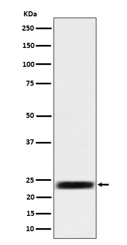 Rabbit monoclonal antibody