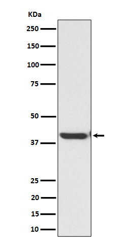 Rabbit monoclonal antibody