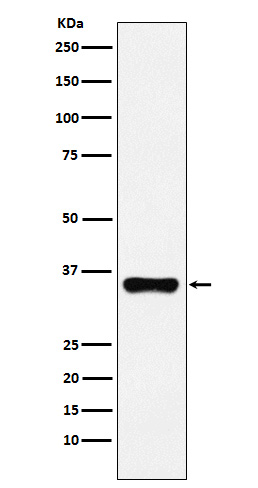 Rabbit monoclonal antibody