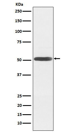 Rabbit monoclonal antibody