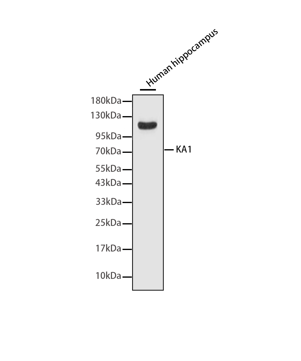 Rabbit monoclonal antibody