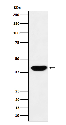 Rabbit monoclonal antibody