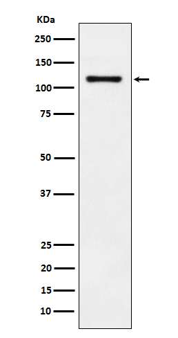 Rabbit monoclonal antibody