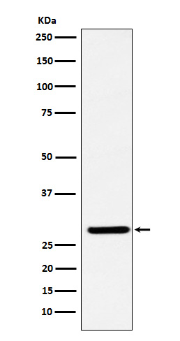 Rabbit monoclonal antibody