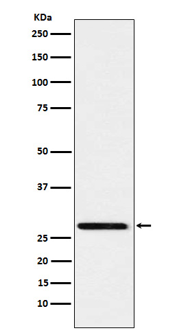 Rabbit monoclonal antibody