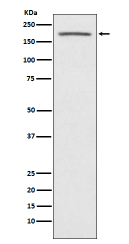 Rabbit monoclonal antibody