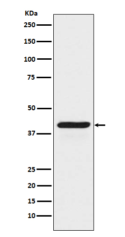 Rabbit monoclonal antibody