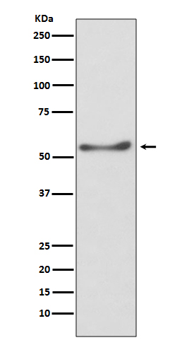 Rabbit monoclonal antibody