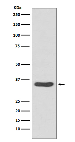 Rabbit monoclonal antibody