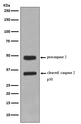 Rabbit monoclonal antibody