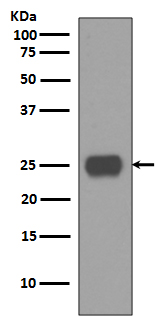 Rabbit monoclonal antibody