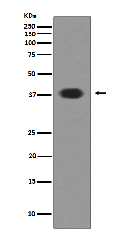 Musashi 1  Rabbit mAb