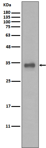Rabbit monoclonal antibody