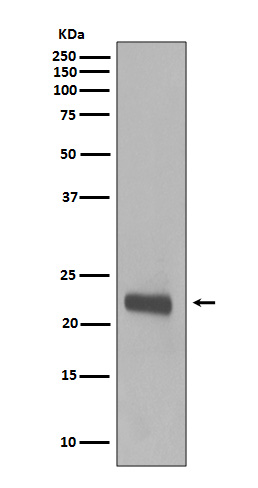 Rabbit monoclonal antibody