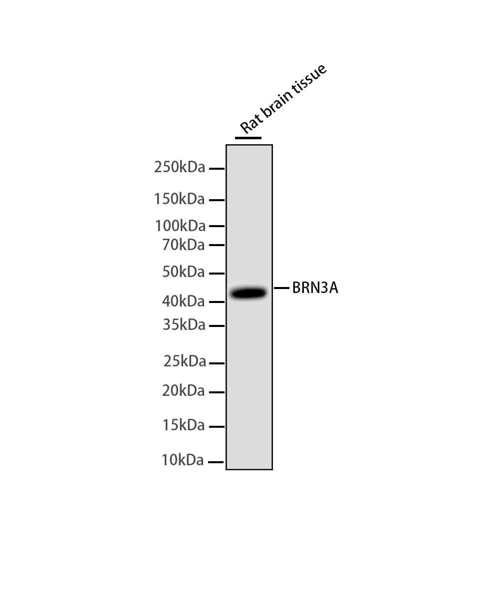 Rabbit monoclonal antibody