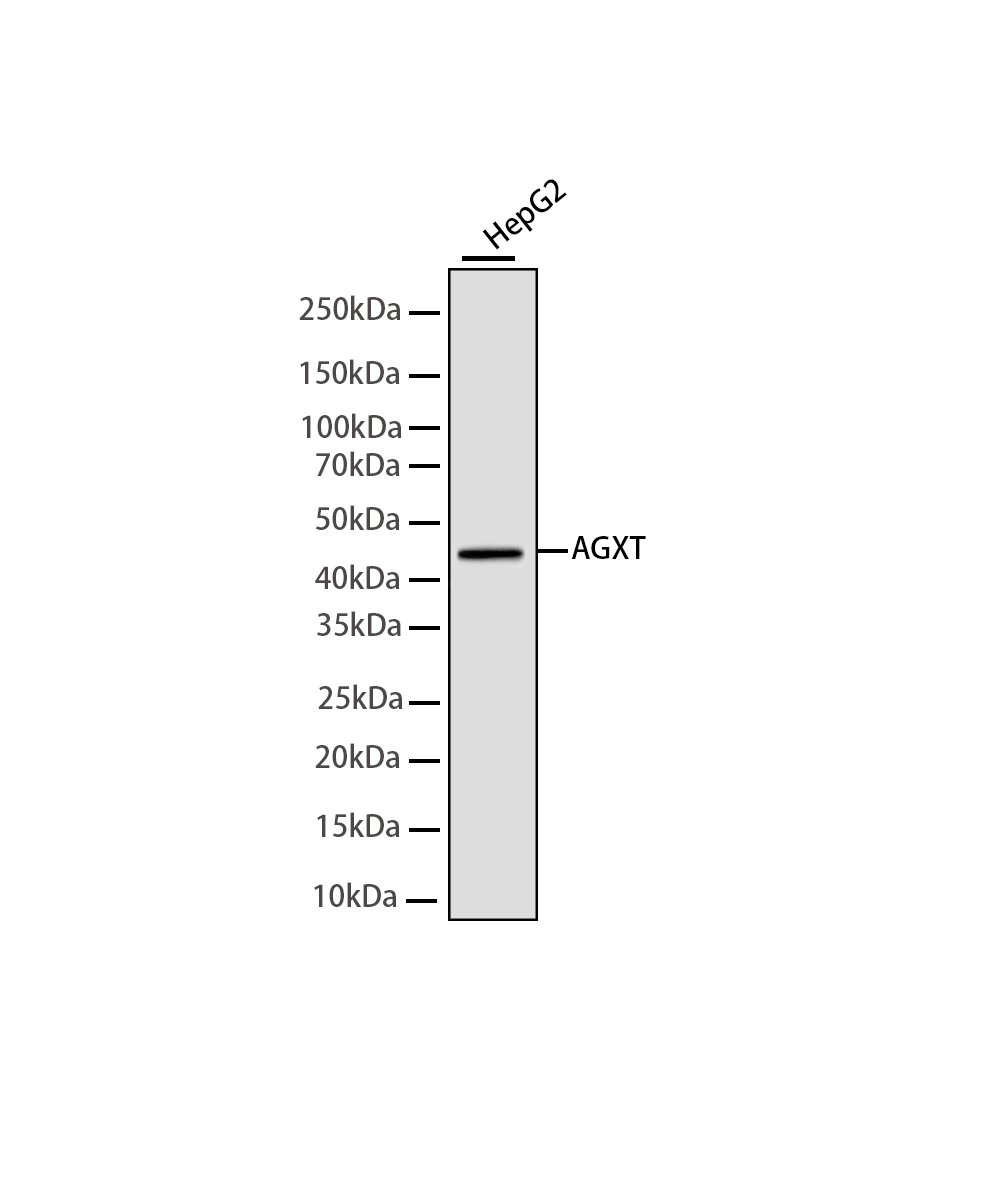 Rabbit monoclonal antibody