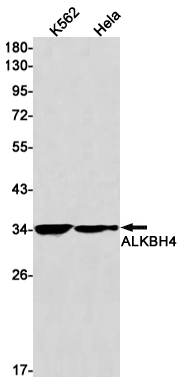 Rabbit monoclonal antibody