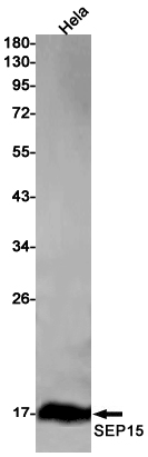 Rabbit monoclonal antibody