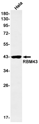 Rabbit monoclonal antibody