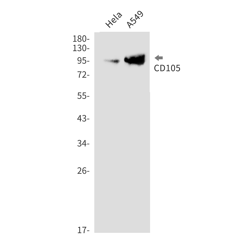 Rabbit monoclonal antibody