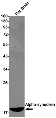 Rabbit monoclonal antibody