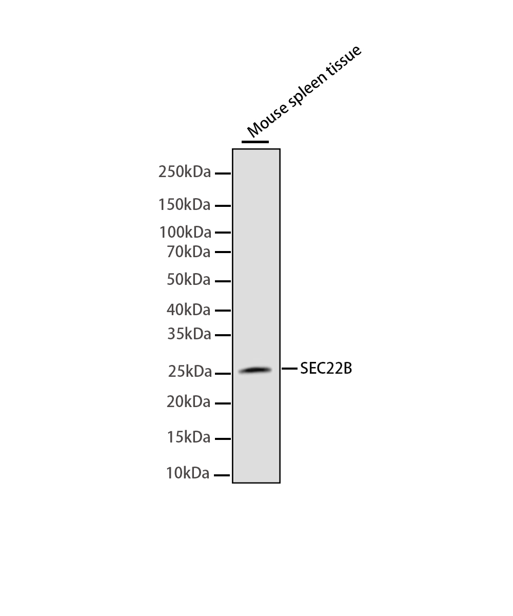 Rabbit monoclonal antibody
