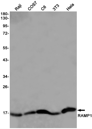 Rabbit monoclonal antibody