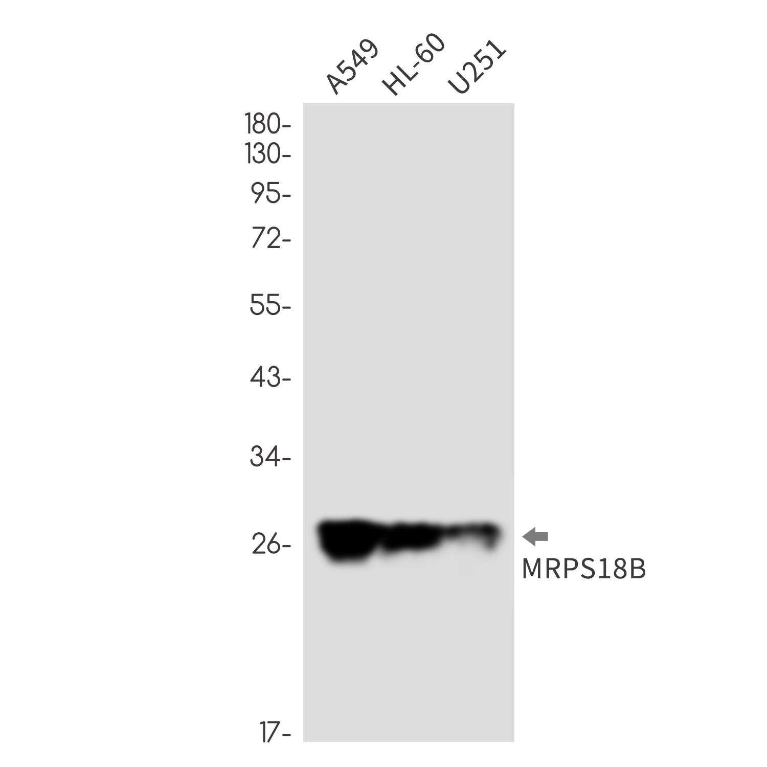 Rabbit monoclonal antibody