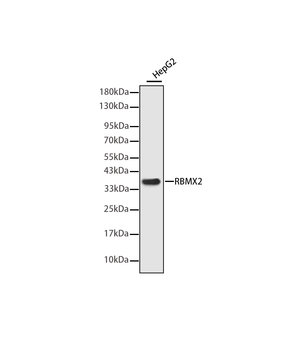 Rabbit monoclonal antibody