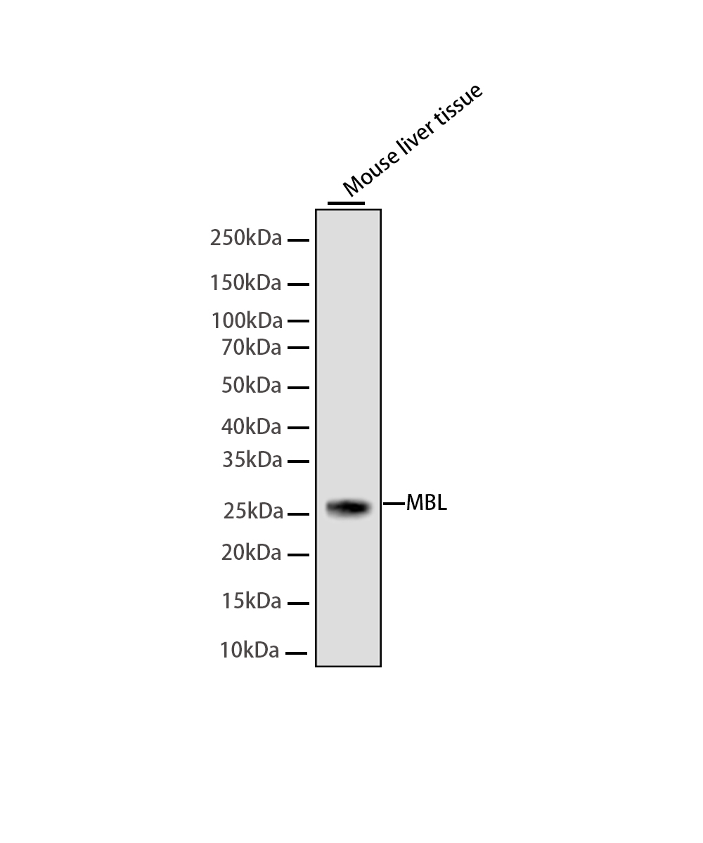 Rabbit monoclonal antibody