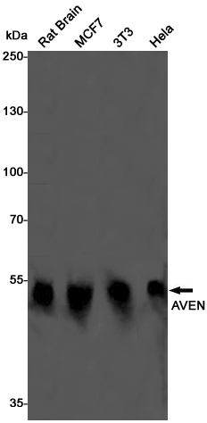 Rabbit monoclonal antibody