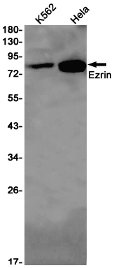 Rabbit monoclonal antibody