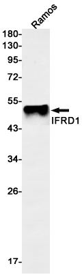 Rabbit monoclonal antibody