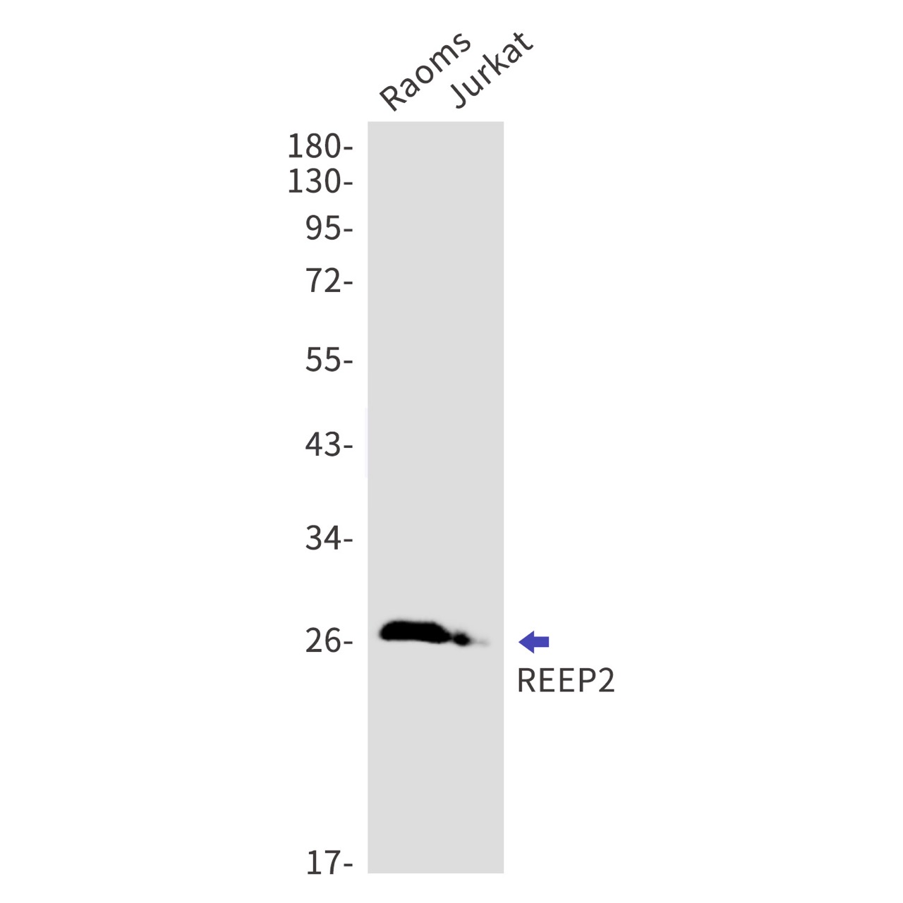 Rabbit monoclonal antibody